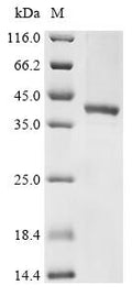 (Tris-Glycine gel) Discontinuous SDS-PAGE (reduced) with 5% enrichment gel and 15% separation gel.
