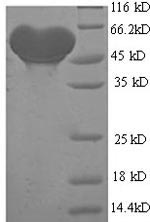Recombinant Human All-trans-retinol dehydrogenase [NAD (+)] ADH1B (ADH1B) – Figure 1 of 1