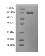 Recombinant Human Alcohol dehydrogenase class-3 (ADH5) – Figure 1 of 1