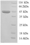 Recombinant Human All-trans-retinol dehydrogenase [NAD (+)] ADH7 (ADH7) – Figure 1 of 1