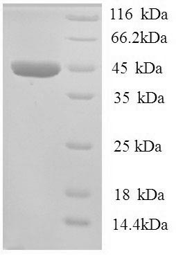 Recombinant Human All-trans-retinol dehydrogenase [NAD (+)] ADH7 (ADH7) – Figure 1 of 1