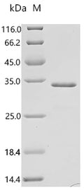 (Tris-Glycine gel) Discontinuous SDS-PAGE (reduced) with 5% enrichment gel and 15% separation gel.