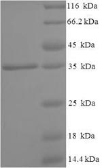 Recombinant Human N (4)- (beta-N-acetylglucosaminyl)-L-asparaginase (AGA), partial – Figure 1 of 1
