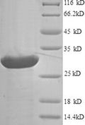 Recombinant Human Agouti-related protein (AGRP) – Figure 1 of 1
