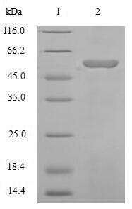 Recombinant Human Angiotensinogen (AGT), partial – Figure 1 of 1