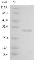 Recombinant Rat Type-2 angiotensin II receptor (Agtr2), partial – Figure 1 of 1