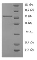 Recombinant Human Serine--pyruvate aminotransferase (AGXT) – Figure 1 of 1