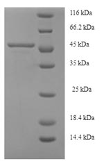 Recombinant Human Serine--pyruvate aminotransferase (AGXT) – Figure 1 of 1