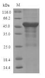 Recombinant Mouse Serine--pyruvate aminotransferase, mitochondrial (Agxt) – Figure 1 of 1