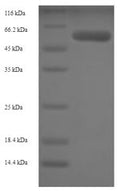 Recombinant Human Adenosylhomocysteinase (AHCY) – Figure 1 of 1
