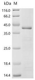 (Tris-Glycine gel) Discontinuous SDS-PAGE (reduced) with 5% enrichment gel and 15% separation gel.
