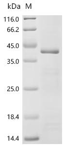 (Tris-Glycine gel) Discontinuous SDS-PAGE (reduced) with 5% enrichment gel and 15% separation gel.