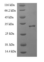 Recombinant Human Allograft inflammatory factor 1 (AIF1) – Figure 1 of 1