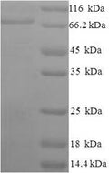 Recombinant Human Apoptosis-inducing factor 1, mitochondrial (AIFM1), partial – Figure 1 of 1