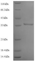 Recombinant Human Adenylate kinase isoenzyme 1 (AK1) – Figure 1 of 1