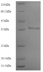 Recombinant Human Adenylate kinase isoenzyme 1 (AK1) – Figure 1 of 1