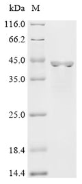 (Tris-Glycine gel) Discontinuous SDS-PAGE (reduced) with 5% enrichment gel and 15% separation gel.