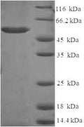 Recombinant Human Aldo-keto reductase family 1 member C2 (AKR1C2) – Figure 1 of 1