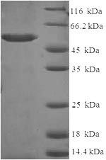 Recombinant Human Aldo-keto reductase family 1 member C2 (AKR1C2) – Figure 1 of 1