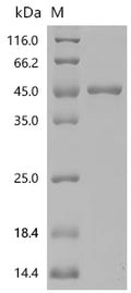 (Tris-Glycine gel) Discontinuous SDS-PAGE (reduced) with 5% enrichment gel and 15% separation gel.