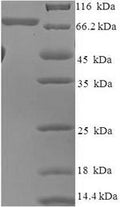 Recombinant Human RAC-beta serine/threonine-protein kinase (AKT2) – Figure 1 of 1