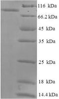 Recombinant Macaca fascicularis albumin (ALB) – Figure 1 of 1