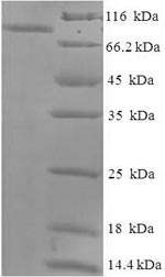 Recombinant Macaca fascicularis albumin (ALB) – Figure 1 of 1