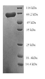 Recombinant Human Succinate-semialdehyde dehydrogenase, mitochondrial (ALDH5A1) – Figure 1 of 1