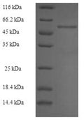Recombinant Rabbit Fructose-bisphosphate aldolase B (ALDOB) – Figure 1 of 1