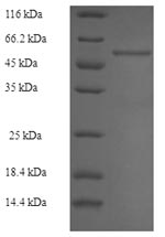 Recombinant Rabbit Fructose-bisphosphate aldolase B (ALDOB) – Figure 1 of 1