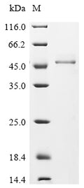(Tris-Glycine gel) Discontinuous SDS-PAGE (reduced) with 5% enrichment gel and 15% separation gel.