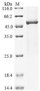 (Tris-Glycine gel) Discontinuous SDS-PAGE (reduced) with 5% enrichment gel and 15% separation gel.