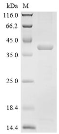 (Tris-Glycine gel) Discontinuous SDS-PAGE (reduced) with 5% enrichment gel and 15% separation gel.