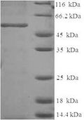 Recombinant Human Annexin A2 (ANXA2) – Figure 1 of 1