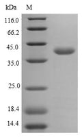 (Tris-Glycine gel) Discontinuous SDS-PAGE (reduced) with 5% enrichment gel and 15% separation gel.