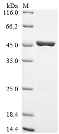 (Tris-Glycine gel) Discontinuous SDS-PAGE (reduced) with 5% enrichment gel and 15% separation gel.