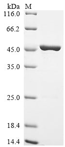 (Tris-Glycine gel) Discontinuous SDS-PAGE (reduced) with 5% enrichment gel and 15% separation gel.