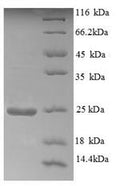 Recombinant Human Aldehyde oxidase (AOX1), partial – Figure 1 of 1