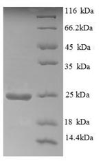 Recombinant Human Aldehyde oxidase (AOX1), partial – Figure 1 of 1