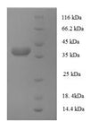 Recombinant Human AP-1 complex subunit sigma-3 (AP1S3) – Figure 1 of 1