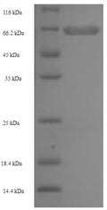 Recombinant Human AP-2 complex subunit mu (AP2M1) – Figure 1 of 1