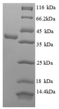 Recombinant Human DNA repair nuclease/redox regulator APEX1 (APEX1) – Figure 1 of 1