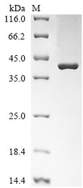 (Tris-Glycine gel) Discontinuous SDS-PAGE (reduced) with 5% enrichment gel and 15% separation gel.