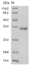 (Tris-Glycine gel) Discontinuous SDS-PAGE (reduced) with 5% enrichment gel and 15% separation gel.