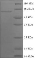 Recombinant Human Apolipoprotein A-IV (APOA4) – Figure 1 of 1
