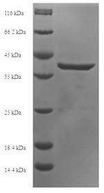 Recombinant Human DNA dC->dU-editing enzyme APOBEC-3A (APOBEC3A) – Figure 1 of 1