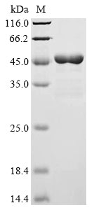 (Tris-Glycine gel) Discontinuous SDS-PAGE (reduced) with 5% enrichment gel and 15% separation gel.