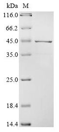 (Tris-Glycine gel) Discontinuous SDS-PAGE (reduced) with 5% enrichment gel and 15% separation gel.