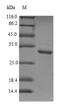 (Tris-Glycine gel) Discontinuous SDS-PAGE (reduced) with 5% enrichment gel and 15% separation gel.