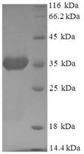 Recombinant Human ADP-ribosylation factor 6 (ARF6) – Figure 1 of 1